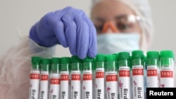 Seseorang menyentuh tabung reaksi berlabel "Flu Burung", dalam sebuah ilustrasi gambar, 14 Januari 2023. (Foto: REUTERS/Dado Ruvic)