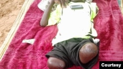 Victim of Wildlife Human conflict