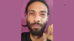 El fotoperiodista Aubrey Baxter