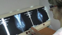 Cancro em Angola - 2:35