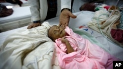 Dokter menyentuh seorang anak yang malnutrisi di rumah sakit di Sana'a, Yaman, di mana setengah dari 22 provinsi negara itu di ambang kelaparan. (AP/Hani Mohammed)