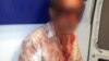 ABŞ Senatoru və Sərhədsiz Reportyorlar İlqar Nəsibovun döyülməsini qəti şəkildə pisləyir 