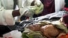 Nestapa Para Ibu dan Anak di Somalia: Meninggal akibat Malnutrisi Parah