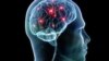 Experts Examine Links Between Brain Injuries and American Football 