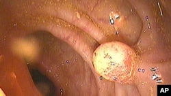 Test de cancer colorectal