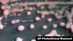 Le nouvel antibiotique serait entièrement efficace contre les bactéries (AP)
