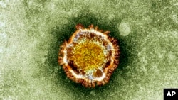 Electron microscope image of a coronavirus, part of a family of viruses that cause ailments including the common cold and SARS (undated)