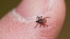 Le virus de la fièvre hémorragique de Crimée-Congo se transmet principalement à l'être humain à partir des tiques dont une est photographiée, ici.
