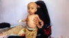 WFP to Resume Food Aid to Yemenis in Houthi-Controlled Area 