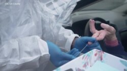 Coronavirus circulando en California desde enero, según investigadores