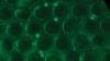 New Test Aims to Make AIDS Diagnosis Easier