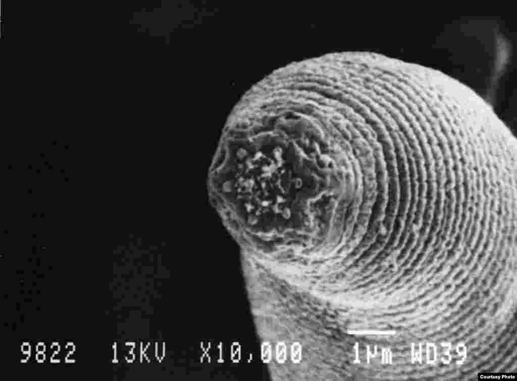 Halicephalobus mephisto. Common Name: Devil’s Worm. These tiny nematodes discovered in a South African gold mine are the deepest-living multicellular organisms on the planet. (Photo: G. Borgonie, Ghent University, Belgium)