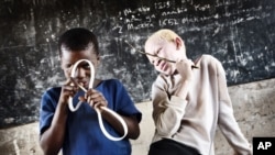Un albinos à droite et son ami