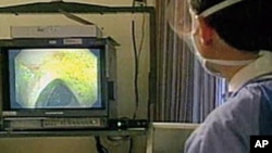 FILE - Colon cancer is one of the world's deadliest diseases, but it often has no symptoms in the early stages. That's why doctors urge adults over 50 to have a colonoscopy to detect any possible cancer.