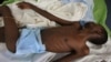 Rights Group Presses for Chronic Pain Care in Senegal