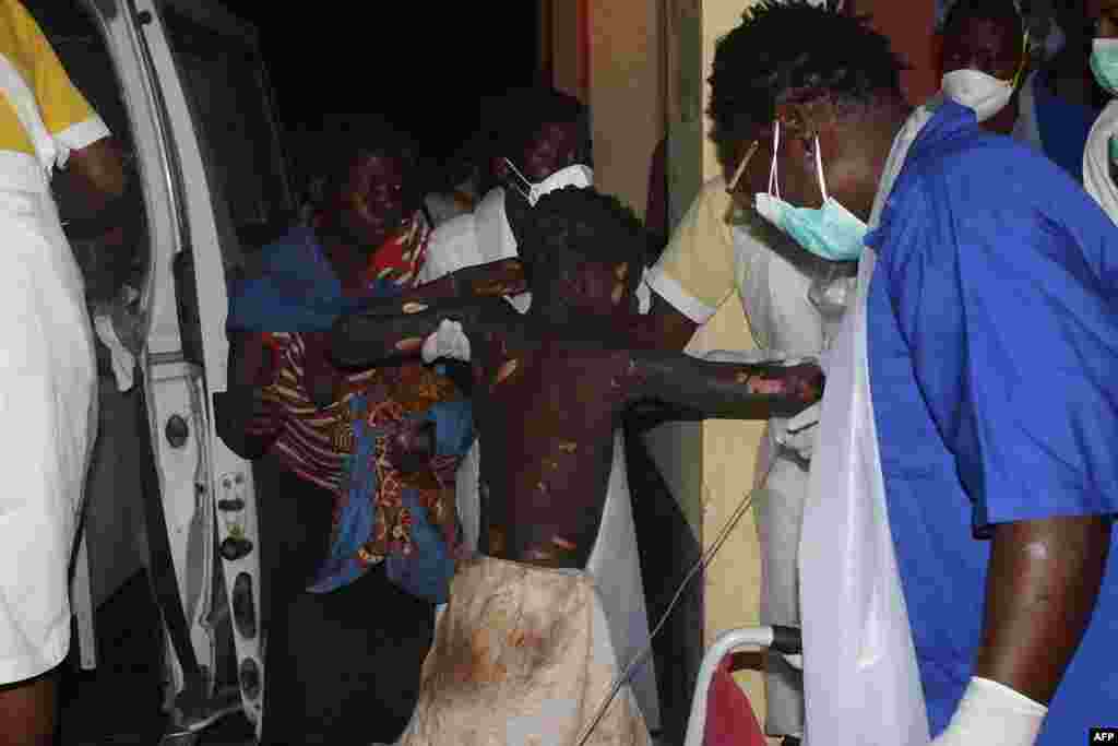 Un enfant gravement brûlé arrive à l'hôpital provincial de Tete, au Mozambique, 17 novembre 2016.