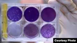 FILE - A researcher holds a tray of Zika virus growing in animal cells at Washington University School of Medicine in St. Louis, Missouri. 