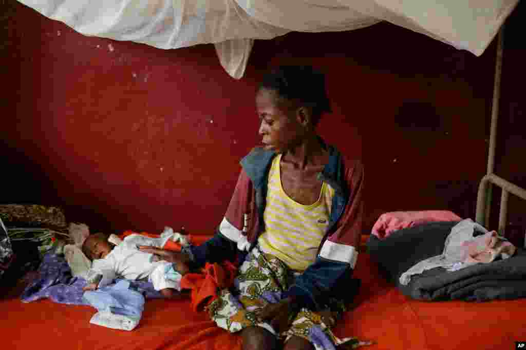 A severely malnourished child lays by his mother at a pediatric center in Bangui, Central African Republic, Dec. 17, 2013.