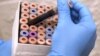 FILE - Lab research analyst does research relating to a new blood test. Researchers have developed a blood test that predicts Alzheimer's disease.