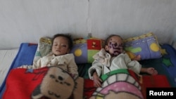 Dua anak balita Korea Utara yang menderita kekurangan gizi parah (foto: dok). UNICEF menyerukan bantuan pengobatan kepada sekitar 25.000 anak balita yang kekurangan gizi sangat parah di sana.