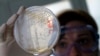 Tehničar u laboratoriji traži elemente bakterije ešerihija koli u ćelijama povrća.
