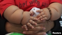 FILE - The World Health Organization is developing recommendations to curb excessive weight in children. 