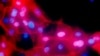 WHO: Cancers Increasing But Not a “Death Sentence”