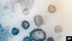 This undated electron microscope image made available by the U.S. National Institutes of Health in February 2020 shows the Novel Coronavirus SARS-CoV-2. Also known as 2019-nCoV, the virus causes COVID-19. The sample was isolated from a patient in…