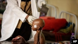 Un enfant mal nourri recevant des soins médicaux à Maiduguri, Nigeria, le 29 aout 2016. 