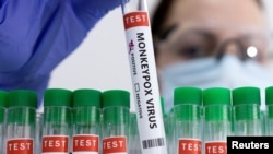 Illustration montrant des tubes à essai étiquetés "virus de la variole du singe positif".