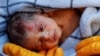 Seorang penyelamat menggendong bayi laki-laki Kerem Agirtas, korban berusia 20 hari yang selamat setelah ditarik dari bawah reruntuhan, pasca gempa di Hatay, Turki, 8 Februari 2023. (Foto: REUTERS/Kemal Aslan)