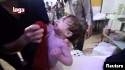 Mtoto akilia kufuatia kile kilichoripotiwa kama shabulizi la kutumia gesi ya sumu nchini Syria.