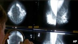 Ahli radiologi menggunakan kaca pembesar untuk memeriksa hasil mammogram kanker payudara di Los Angeles. (Foto: dok.)