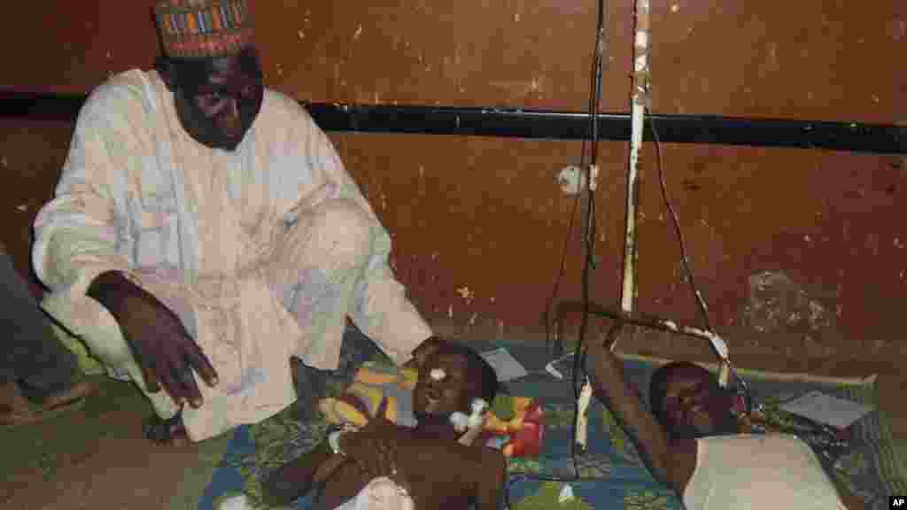 Ana jinyar wadanda suka ji rauni a babban Asibitin Potiskum, wanda yake dab da MKakarantar Sakandaren Kimiyya ta Gwamnati inda a yau Litinin 10 Nuwamba 2014 wani dan kunar-bakin-wake ya kai harin bam