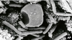 L'anthrax est le terme anglo-saxon donné à la "maladie du charbon", qui forme des sortes de gros abcès cutanés. 