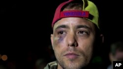 Archivo. El periodista Jesús Medina habla con la prensa en Caracas, Venezuela, el 7 de noviembre de 2017.