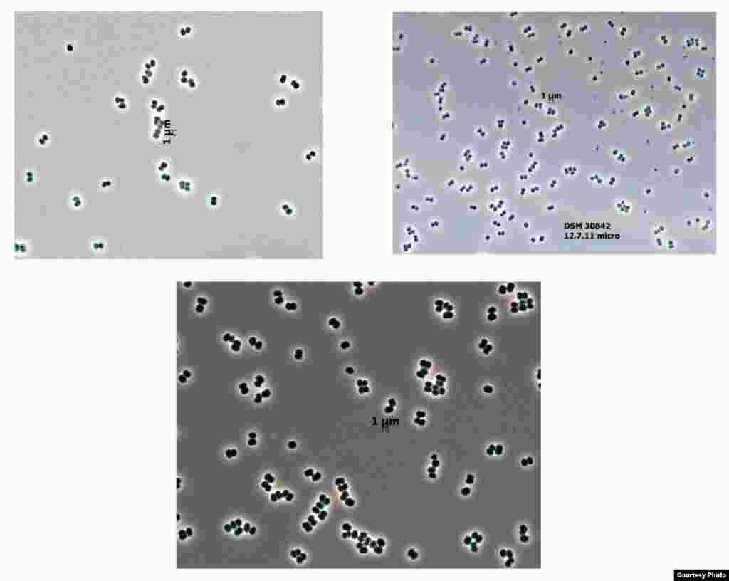 FoClean Room Microbes – ‘จุลินทรีย์ห้องสะอาด’ อาศัยอยู่ในห้องปลอดเชื้อขององค์การนาซ่าที่รัฐฟลอริด้า ซึ่งเป็นห้องที่สร้างขึ้นเพื่อป้องกันเชื้อโรคและจุลินทรีย์ต่างๆ ไม่ให้ติดไปกับยานอวกาศที่ไปลงจอดบนดาวดวงอื่น แต่นักวิทยาศาสตร์พบจุลินทรีย์ชนิดนี้ในห้องปลอดเชื้อดังกล่าว และยังพบด้วยว่าจุลินทรีย์นี้มีความทนทานต่อความแห้งแล้ง สภาพความเป็นกรด สภาพอากาศรุนแรง และรังสี UV ทำให้เกิดความกังวลว่าจุลินทรีย์ชนิดนี้อาจติดไปกับยานอวกาศที่ไปลงจอดดาวดวงอื่นได้ 